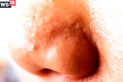 From Honey to Sandalwood, Natural Ways to Get Rid of Oily Nose