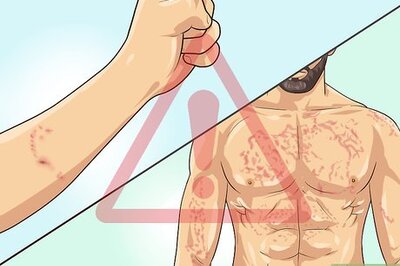 How to Diagnose Septic Arthritis