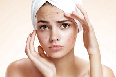 Know What Is Cystic Acne And Easy Ways To Get Rid Of It