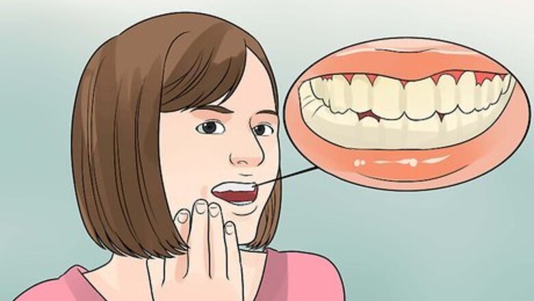 How to Determine if a Tooth Needs to Be Pulled