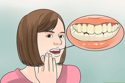 How to Determine if a Tooth Needs to Be Pulled