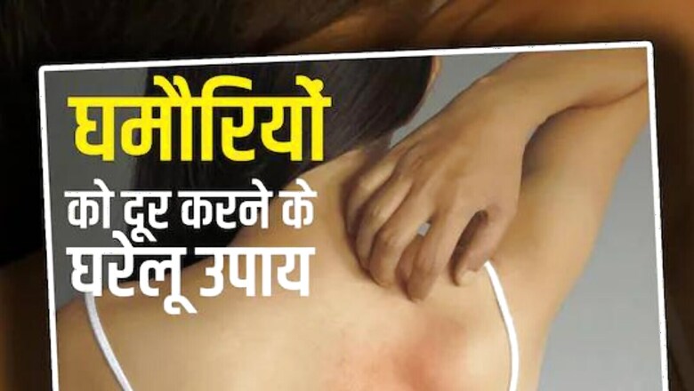 Oatmeal to Aloe Vera Gel, Homes Remedies For Prickly Heat