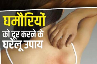 Oatmeal to Aloe Vera Gel, Homes Remedies For Prickly Heat