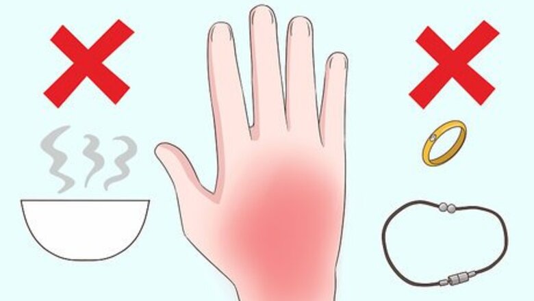 How to Treat Scalds