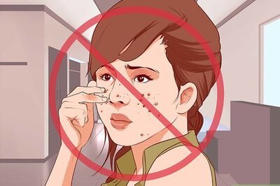 How to Reduce Acne Redness Quickly