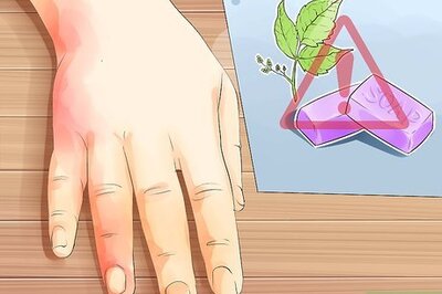 How to Treat Dermatitis