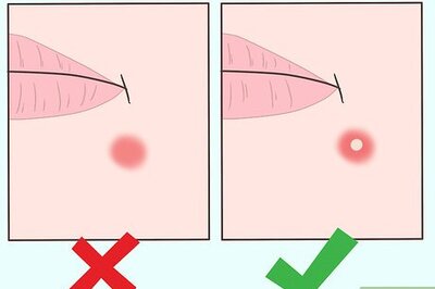How to Pop a Whitehead