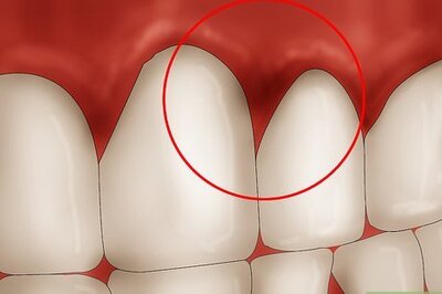 How to Get Rid of Gingivitis