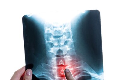 World Spine Day 2021: Theme, History and Significance