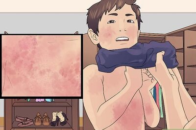 How to Recognize and Treat Scarlet Fever