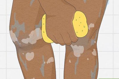 How to Lighten Dark Knees: Natural Remedies & More