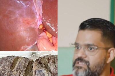 Doctor Calls Out Instagram's Policy On Alcohol Content: ‘IG Is Funny’