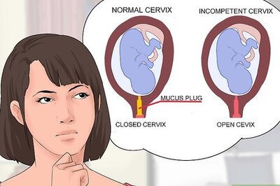 How to Prevent Incompetent Cervix