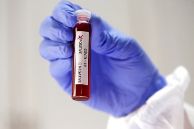 Covid-19 Test Now Available on Practo for Rs 4,500