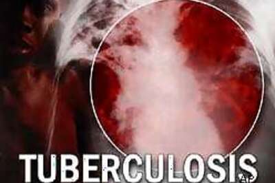 US pledges $4.17 mn fighting TB in India