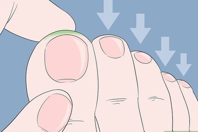 How to Treat Migraines: Can Reflexology Help?