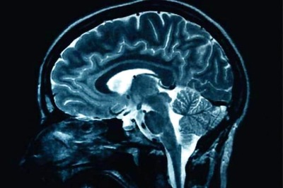 A Virus-inspired Method for Drug Delivery to the Brain Developed, Says Study