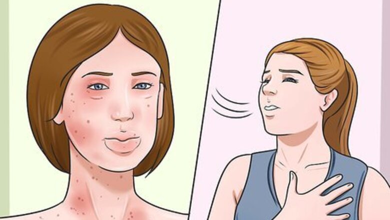 How to Treat Allergies