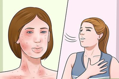 How to Treat Allergies