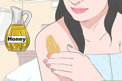 How to Stop Mosquito Bites from Itching