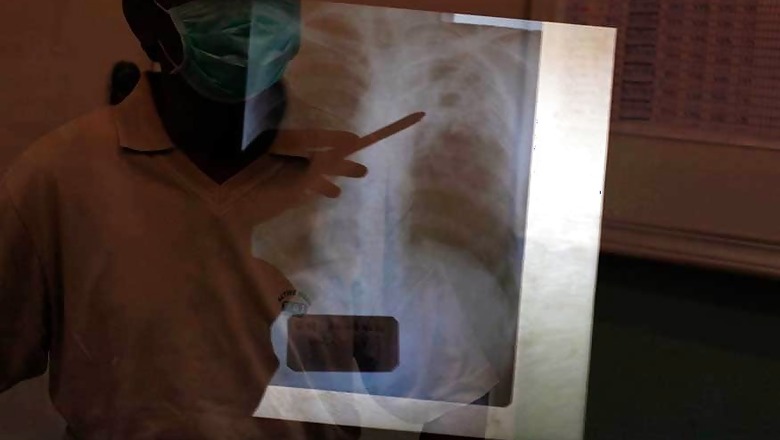 India to Roll Out Shorter Treatments for Drug Resistant Tuberculosis