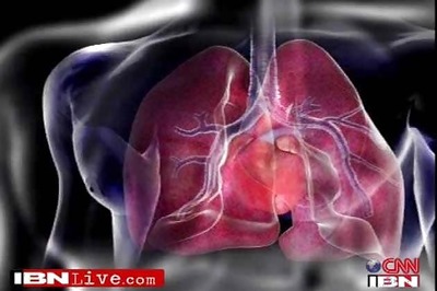 'Dead' hearts transplanted into living patients in world first