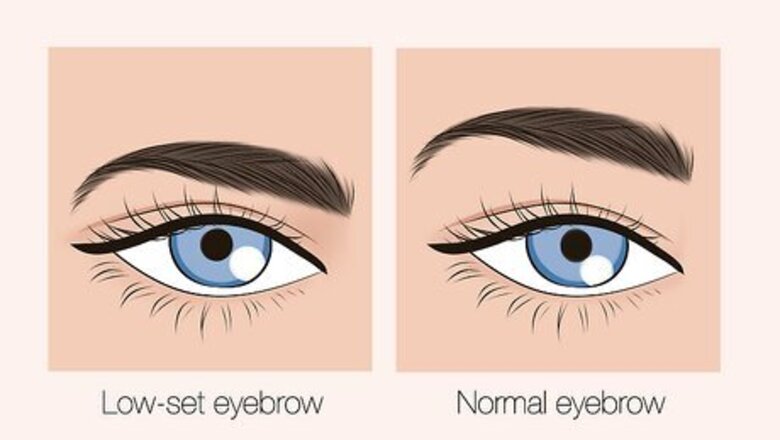 All About Low-Set Eyebrows: How to Fix Them or Get Them
