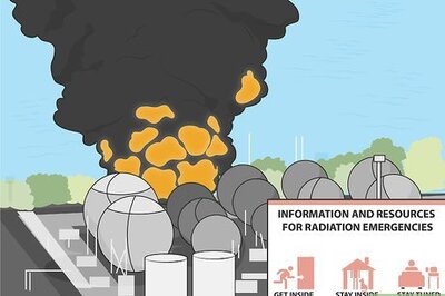 How to Treat Radiation Burns