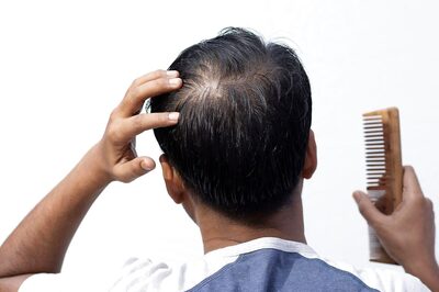 Can A Hair Loss Treatment Ruin Your Sex Life?