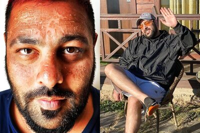 Badshah Suffers Sunburn While Holidaying in Maldives, Check Out Varun Dhawan's Comment