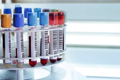 Experimental blood test may find multiple diseases