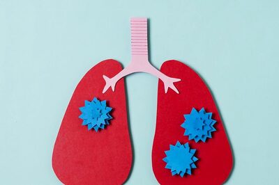 The Challenge of Drug-Resistant Tuberculosis and the Call for Innovative Therapies