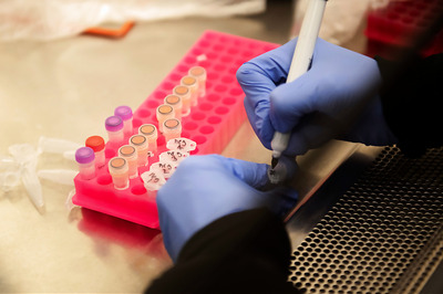 WHO Says First Results from Drug Trials Expected Within 2 Weeks as Covid-19 Cases Exceed 11 Million