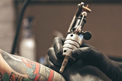 Things to Think About When Removing a Tattoo