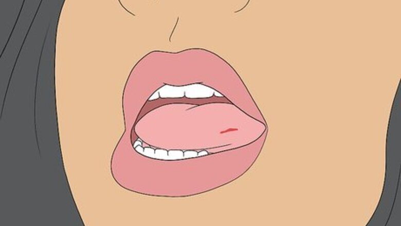 How to Diagnose and Treat Mouth Pain