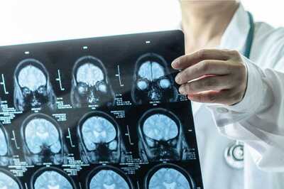 World Brain Tumor Day 2022: History, Significance and Theme