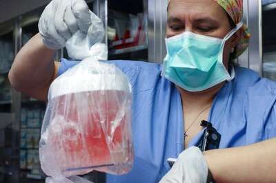 First Recipient Of Genetically Modified Pig Kidney Transplant Passes Nearly 2 Months After Surgery