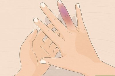 How to Treat a Broken Finger