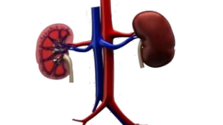 Delhi: Wives' kidney swap gives two men fresh lease of life