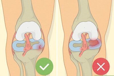 How to Heal a Meniscus Tear