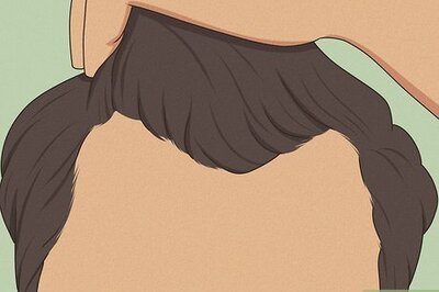 9 Signs You’re Balding at 20 (Plus Causes & Treatment Options)