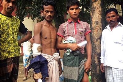 Bangladesh Hospital Struggles to Cope With Rohingya Wounds