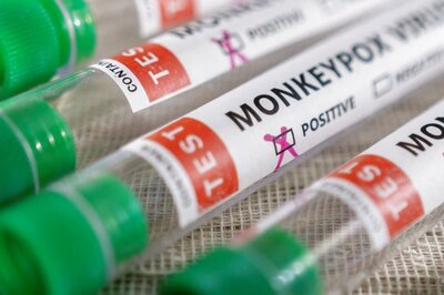 Suspected Case of Monkeypox Found in Telangana