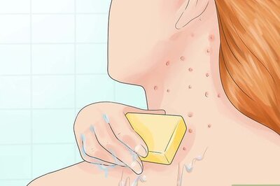 How to Treat Folliculitis