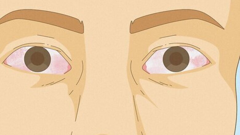 High Eyes, Explained: Causes & How to Get Rid of Them