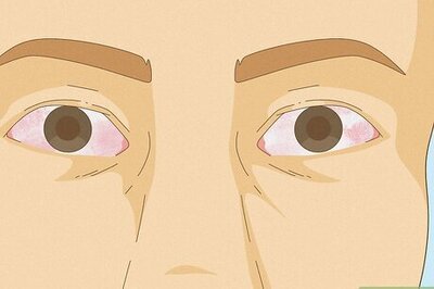 High Eyes, Explained: Causes & How to Get Rid of Them