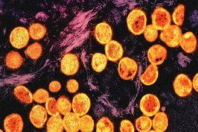 India At A Higher Risk Of Pandemics Due To Emerging Pathogens? What We Know