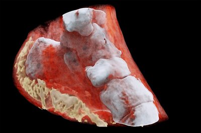 World's First Ever Colour X-Ray Performed On a Human