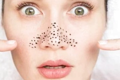 Say Bye To Stubborn Blackheads Using These Simple Tips