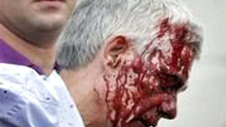 Spain tragedy: Train driver's appearance in court delayed